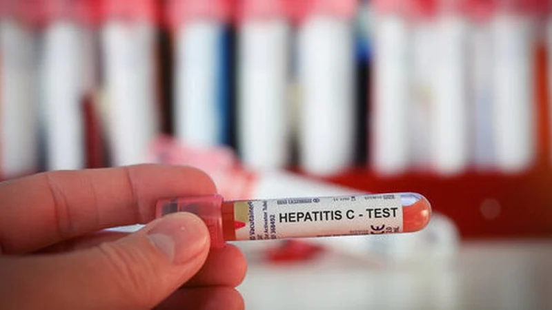 HSE launches free home test for Hepatitis C